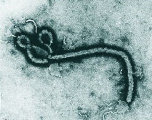 Le virus Ebola (Crédits photo: OMS)