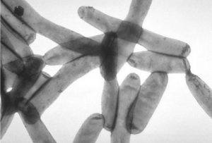 La bactérie Legionella pneumophilia responsable de la légionellose
